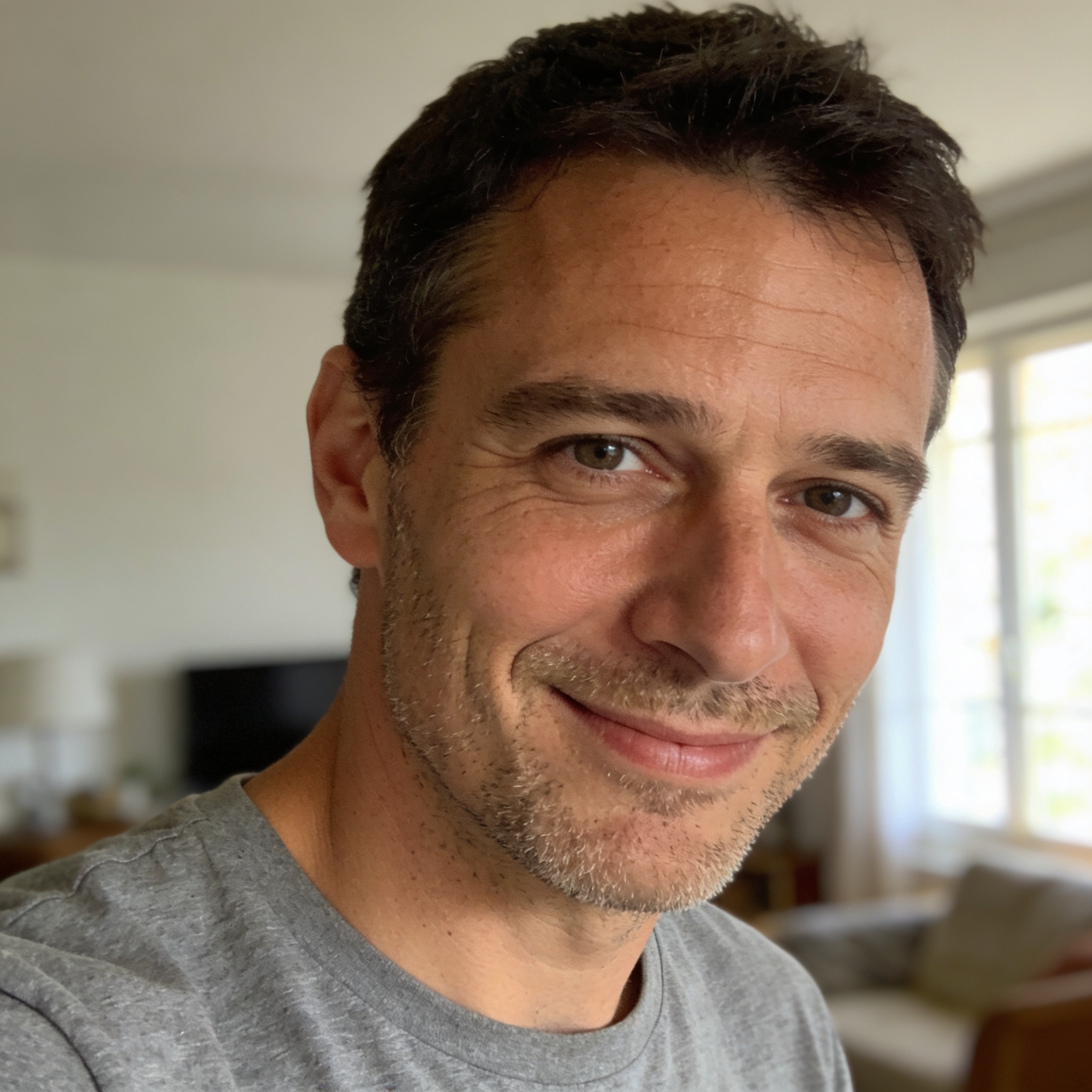Avant après double menton Marc, 36 ans