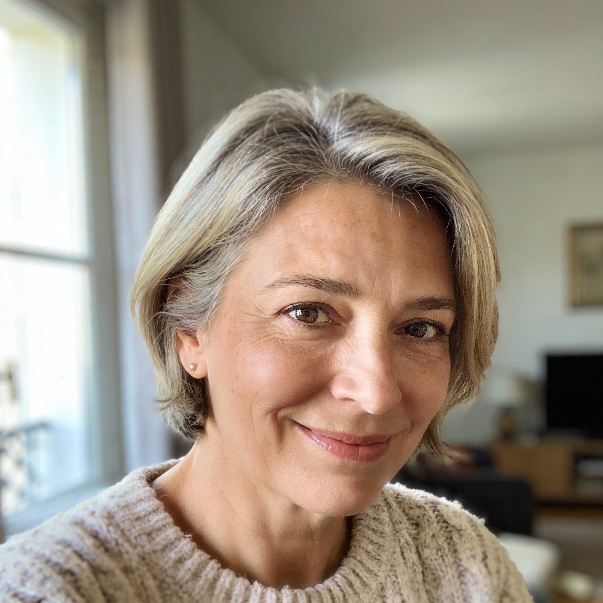 Avant après double menton Martine, 52 ans